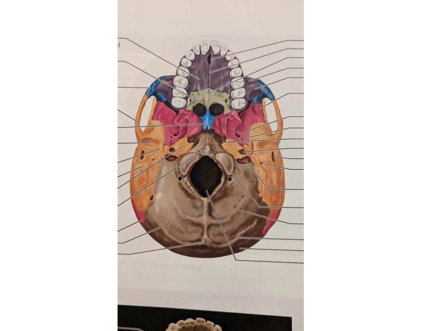 Human Anatomy: Bottom View of the Human Skull Quiz