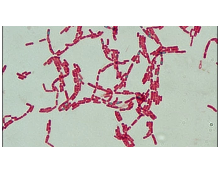 Endospore Gram+ Rods bacteria-disease Quiz
