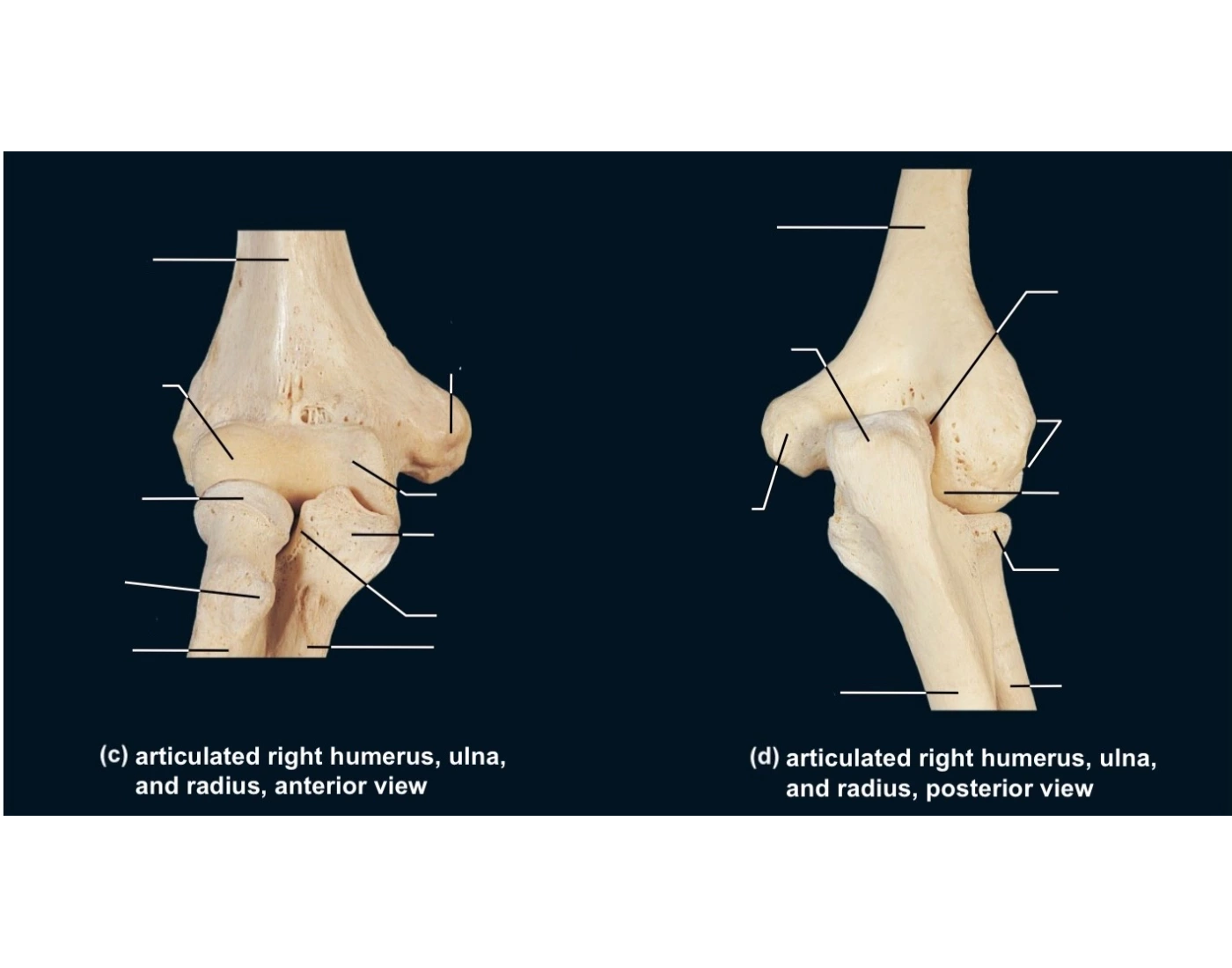 Humerus Ulna Radius