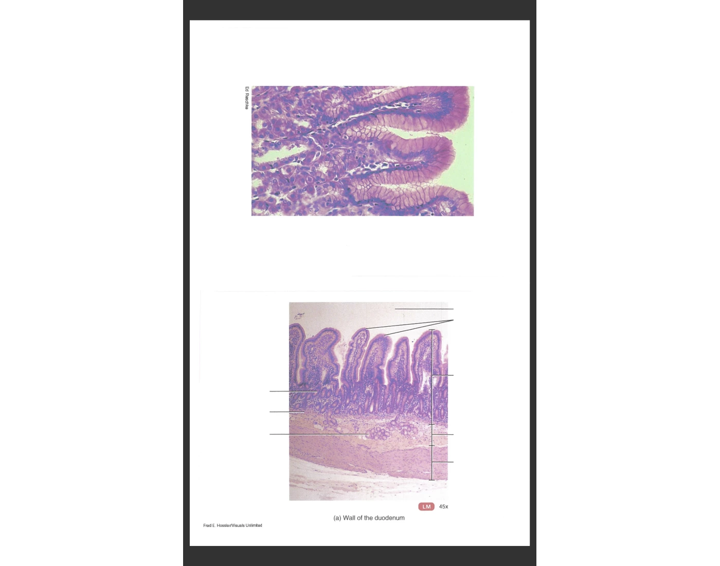 wall of duodenum Quiz
