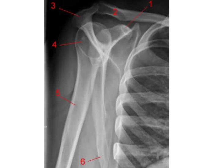 Lateral Shoulder Anatomy Quiz