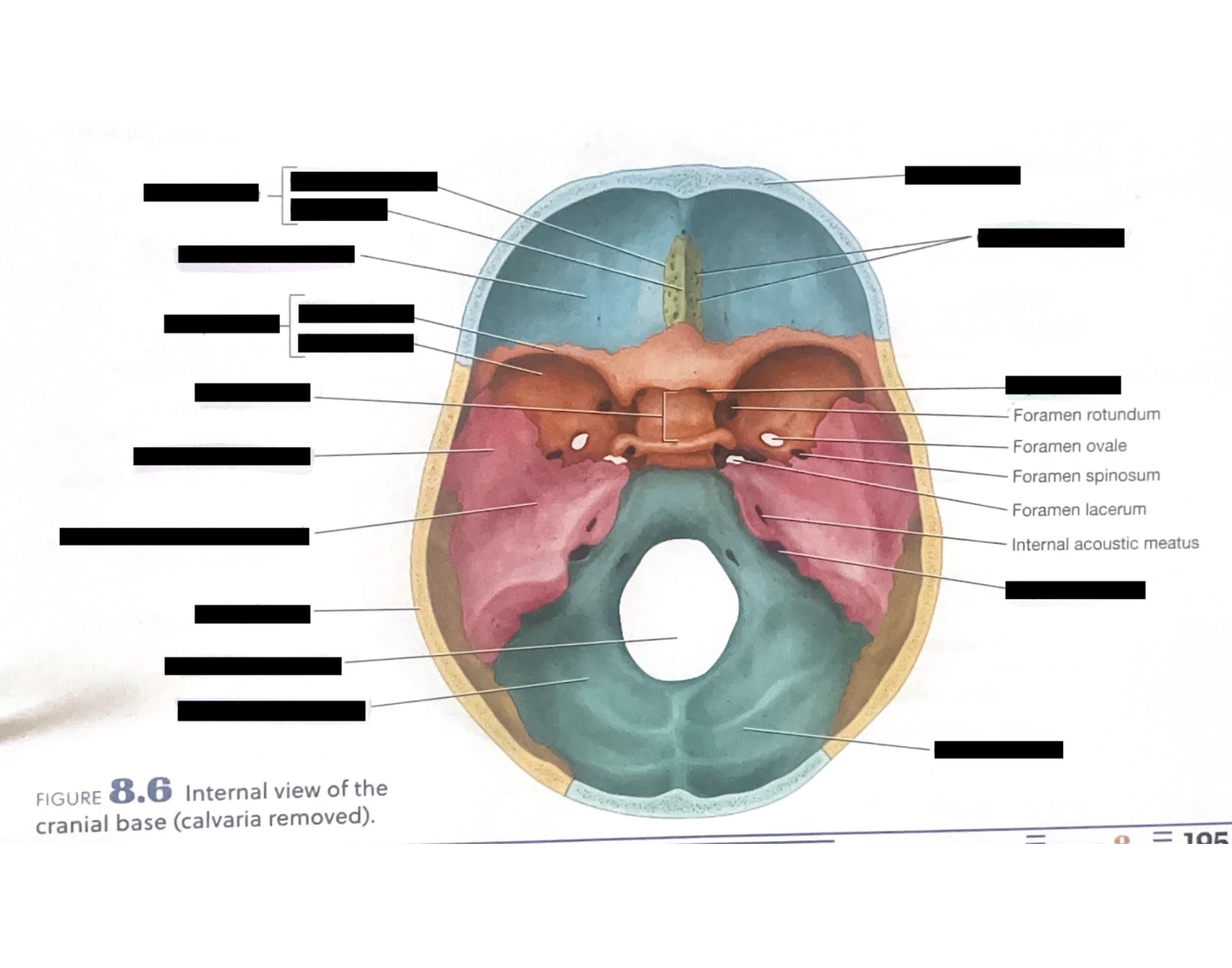 Cranial View Internal View of Cranial Base Quiz