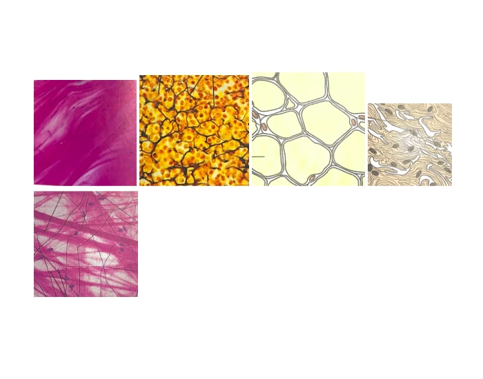 Connective Tissue Worksheet.pdf Connective tissues proper (loose and dense) — Printable Worksheet