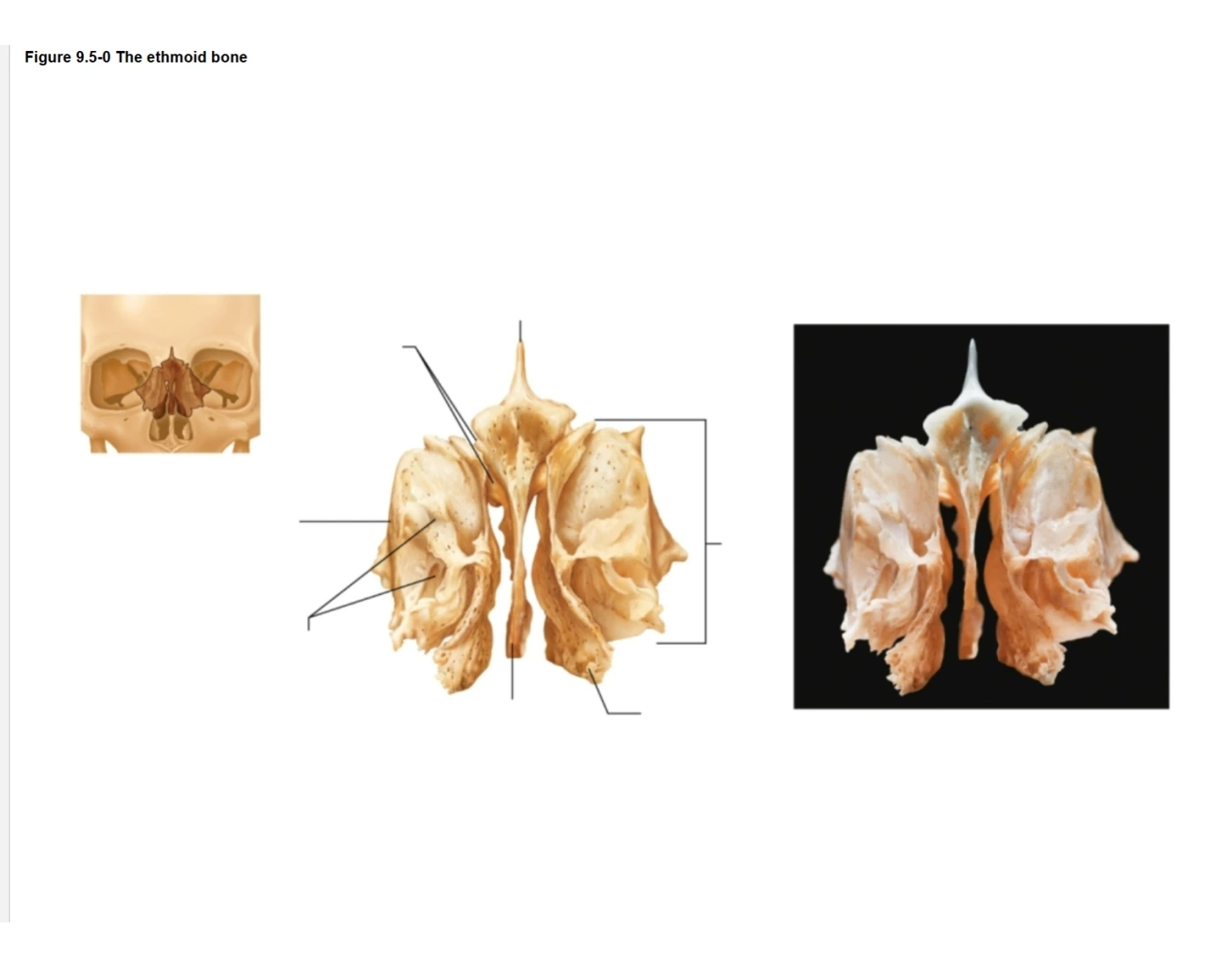 Label The Superior Ethmoid Bone Printable Worksheet
