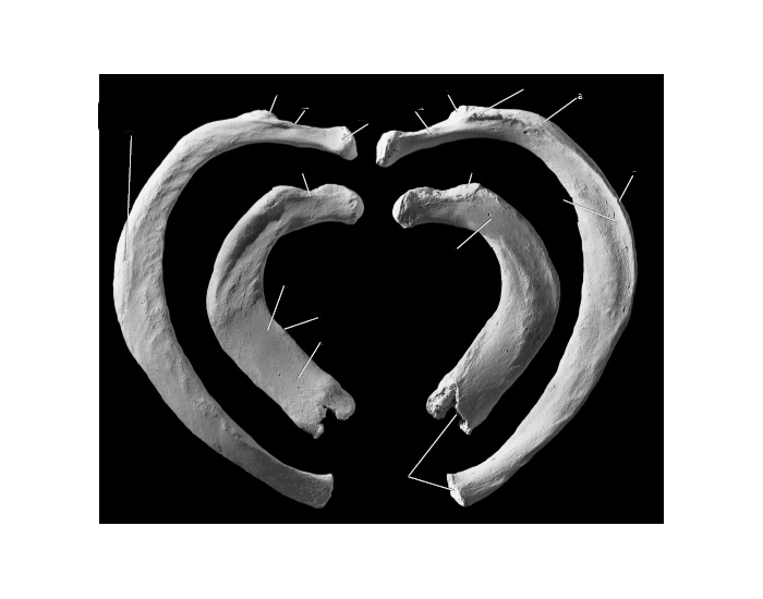 1st and 2nd rib anatomy Quiz