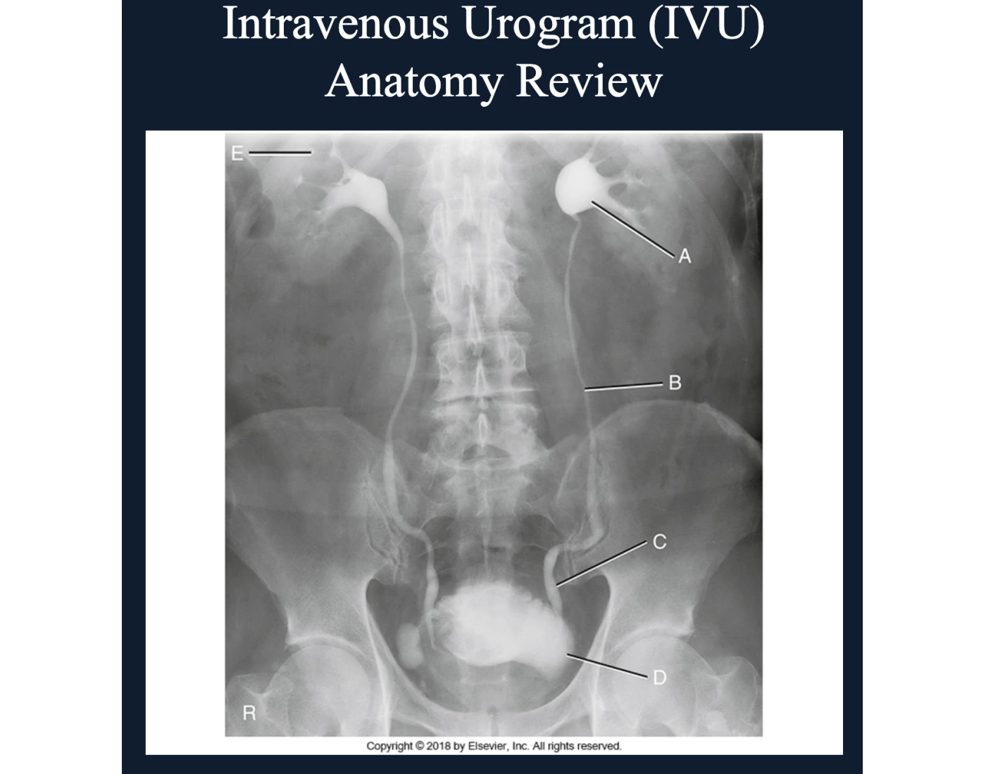 Urogram Tools Anatomy on a Urogram Quiz