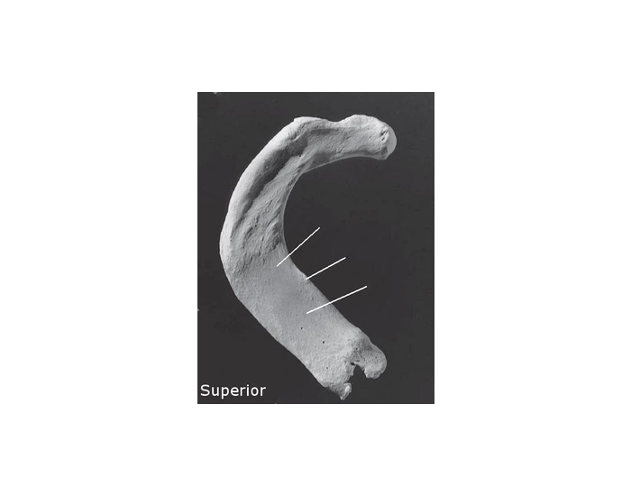 Parts of 1st rib — Printable Worksheet