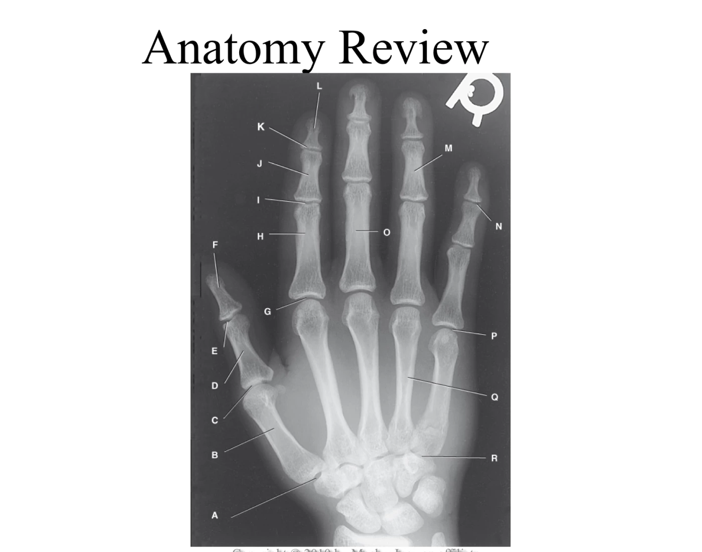 Pat Hand Example FULL PA HAND DIAGRAM PROCEDURES Quiz