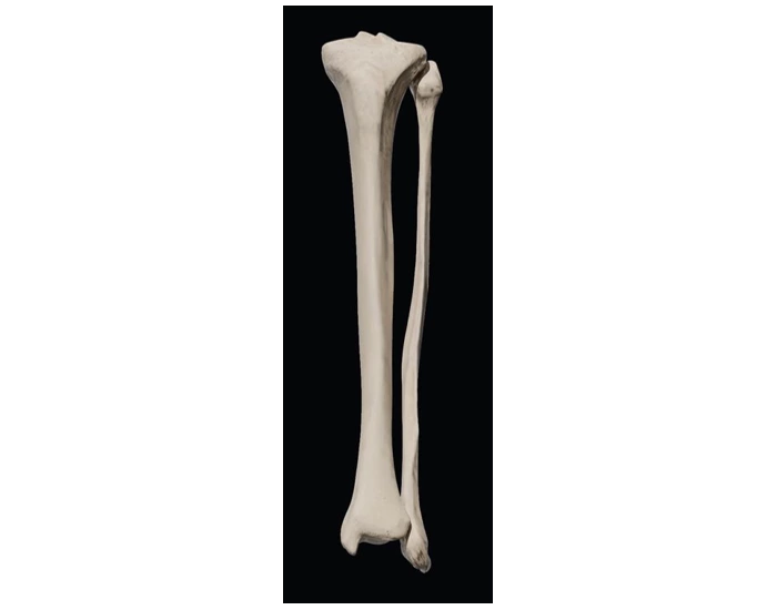 Tib/Fib Anatomy Bone landmarks Quiz