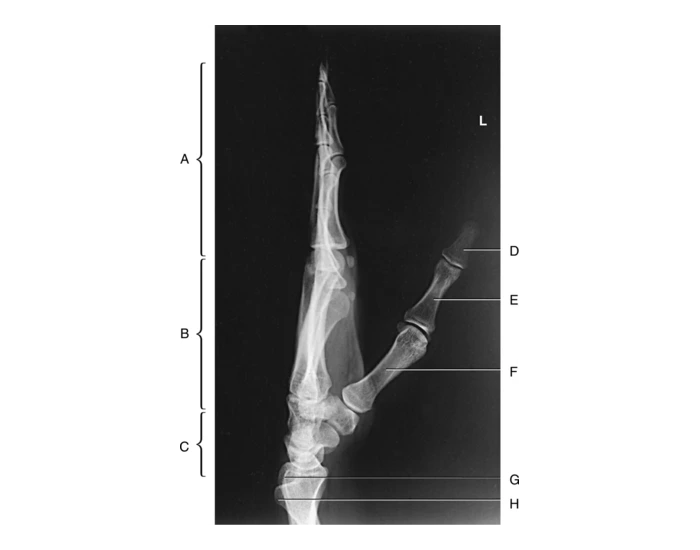 Lateral Rotation Hand x-ray Lateral Hand anatomy Quiz