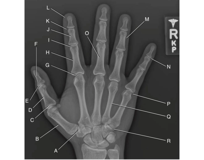 Right Hand Labelled hand anatomy A-R right hand — Printable Worksheet