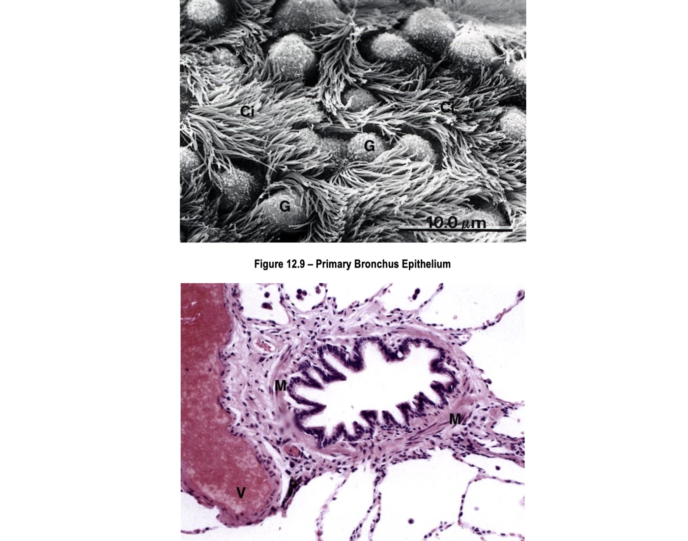 Primary Bronchi Microscope primary bronchus epithelium/bronchiole Quiz