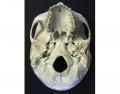 Inferior View of The Skull