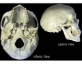 inferior and lateral view of skull
