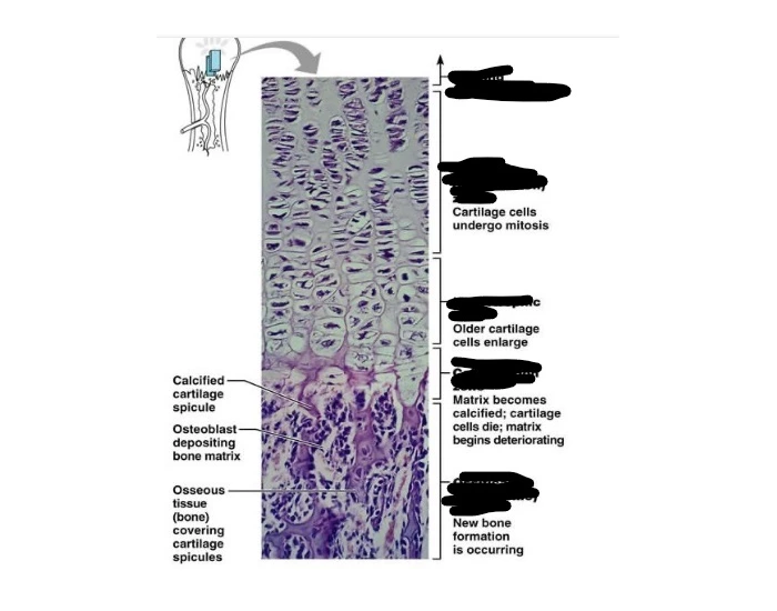 Stages of Bone Quiz