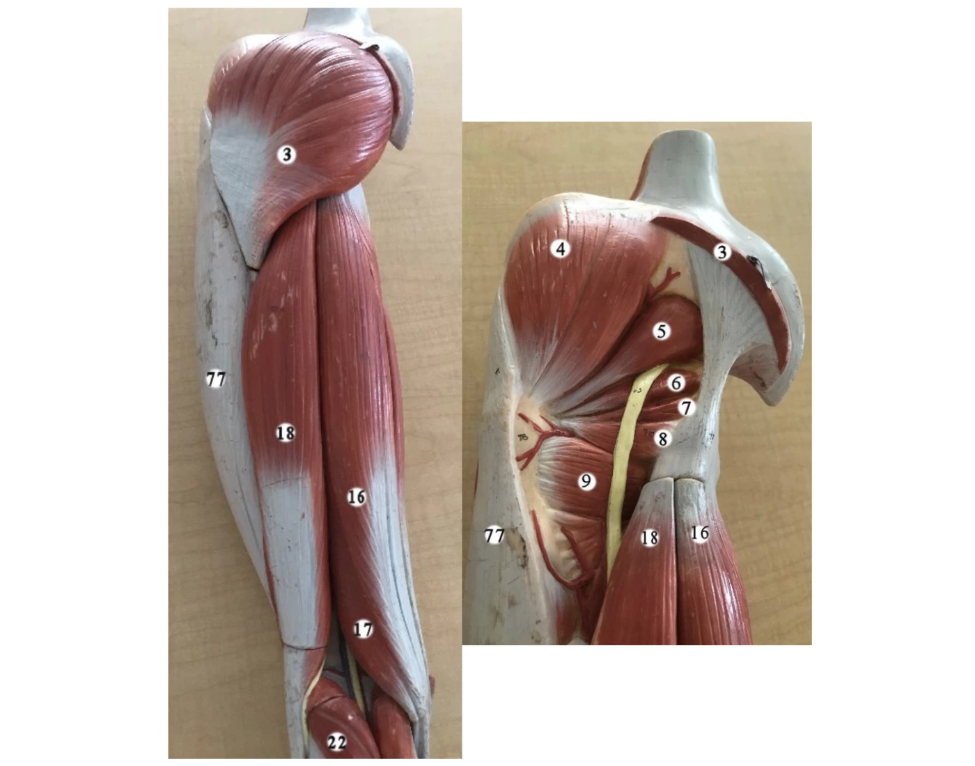 Lower Extermity Lab Model anatomy lab- muscles of lower extremity 3 — Printable Worksheet