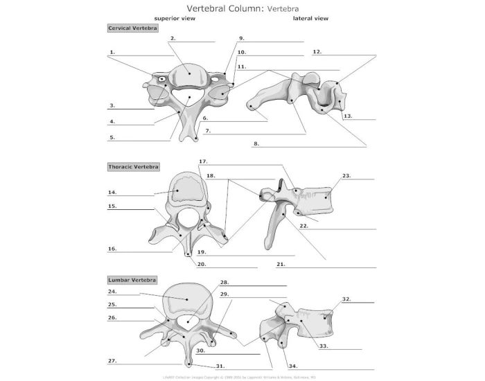 Bone Features Vertebrae -Anatomy and Physiology — Printable Worksheet