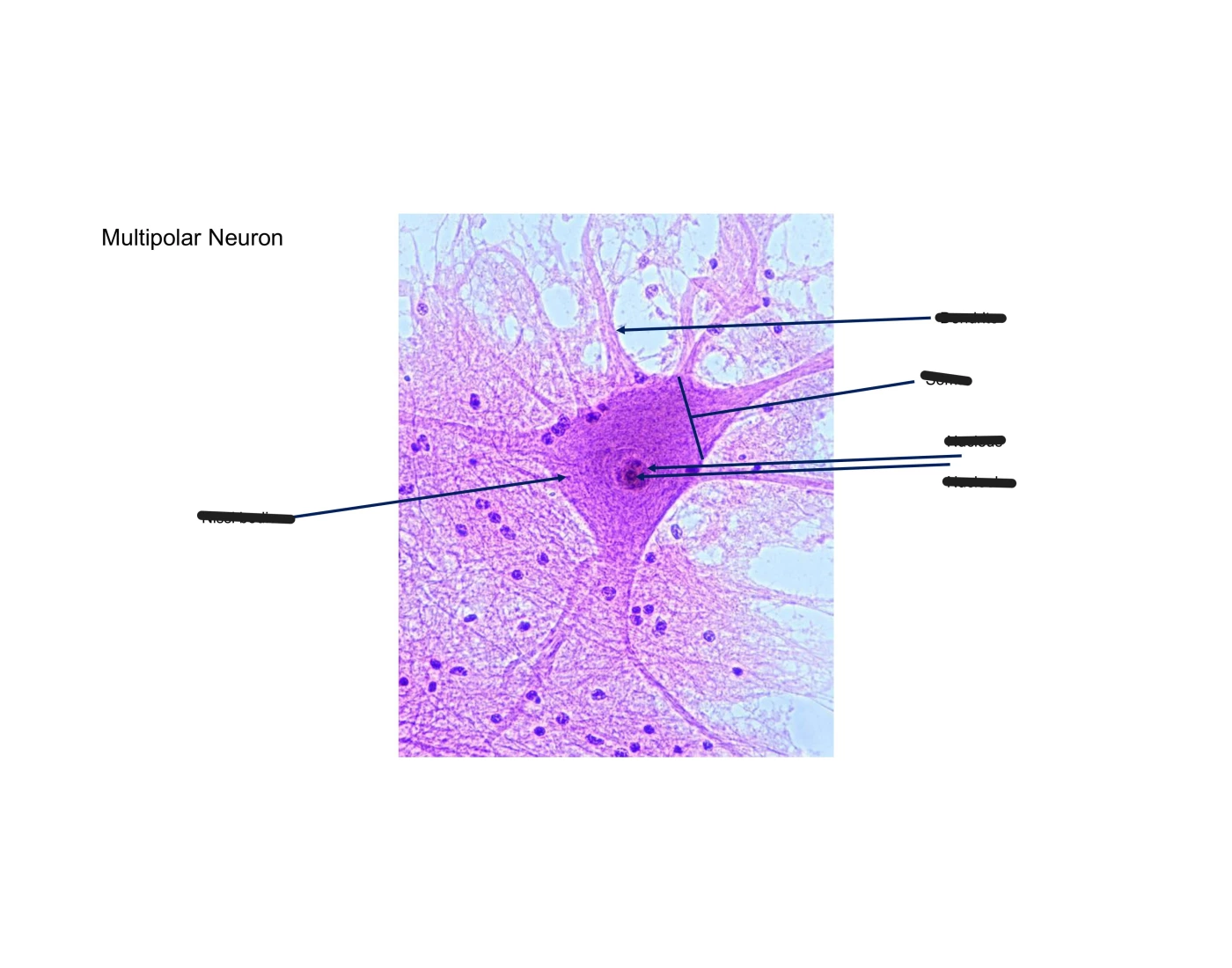 Multipoparl Neuron Multipolar Neuron Quiz