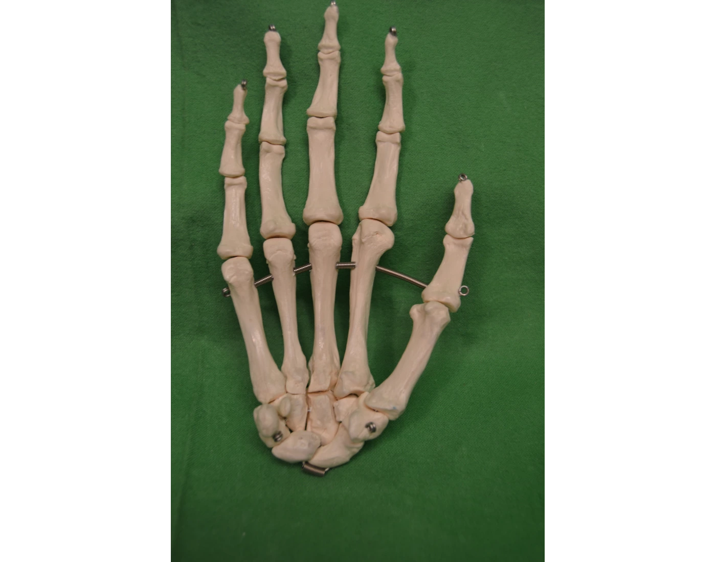 Identify Hand Bones of the Hand Identification — Printable Worksheet