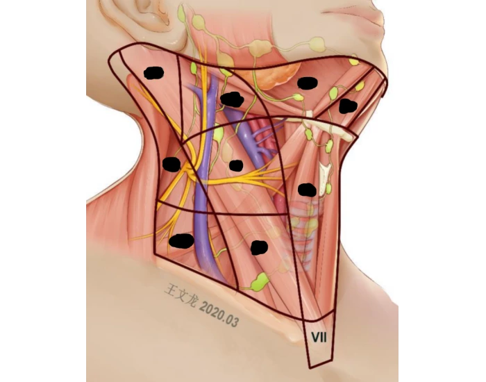 Layered Neck Level Levels of the neck Quiz