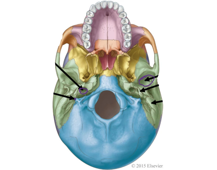 Temporal Bones -Inferior View Quiz