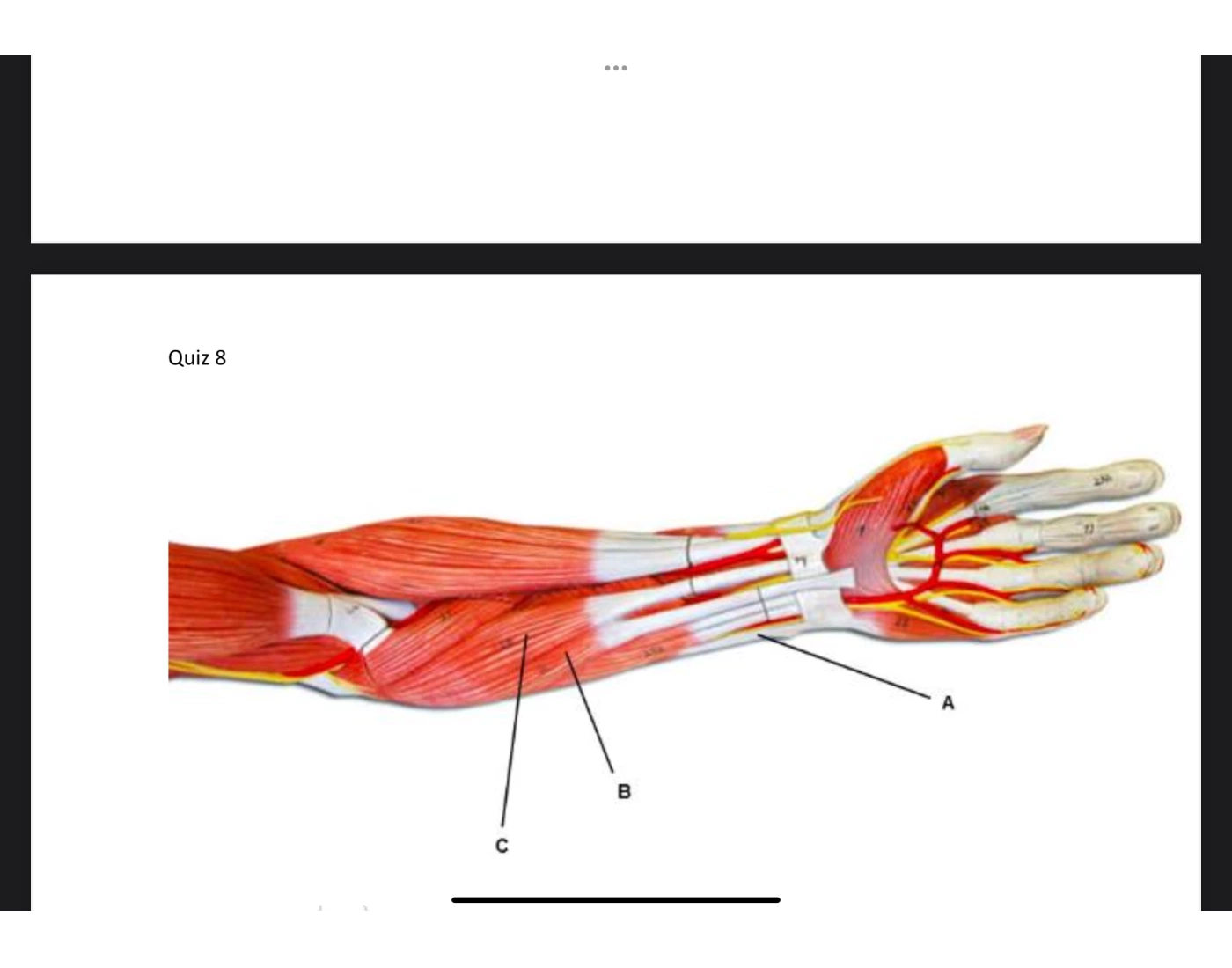 Arm/ hand muscles label Quiz