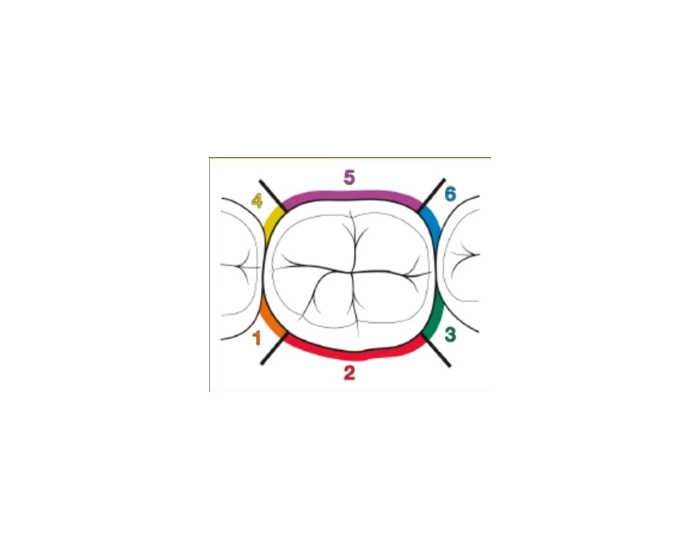 6ppc Length 6PPC tooth surfaces Quiz