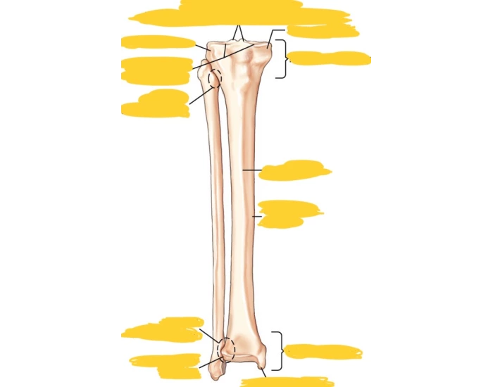 AP Tib-fib — Printable Worksheet