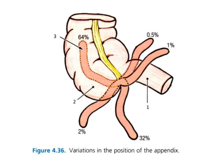 Appendix Positioning Variations in the position of the appendix Quiz