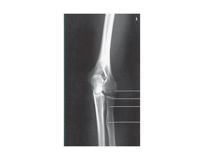 Rotation Lateral Rotation AP Oblique Lateral Rotation Quiz