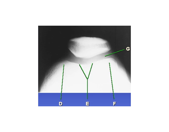 Tangential Patella—Merchant Method Quiz