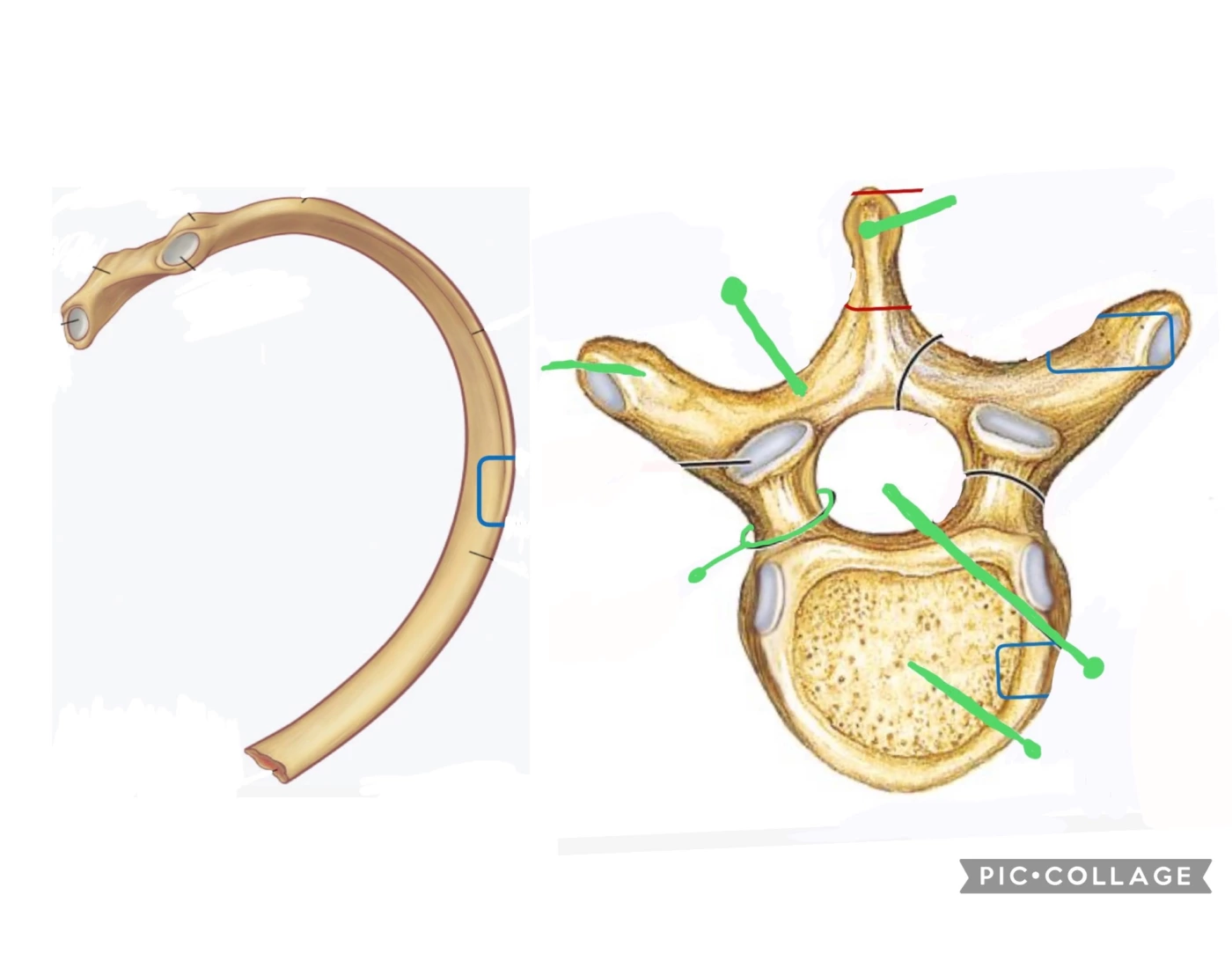 Rib & Vertebrae — Printable Worksheet