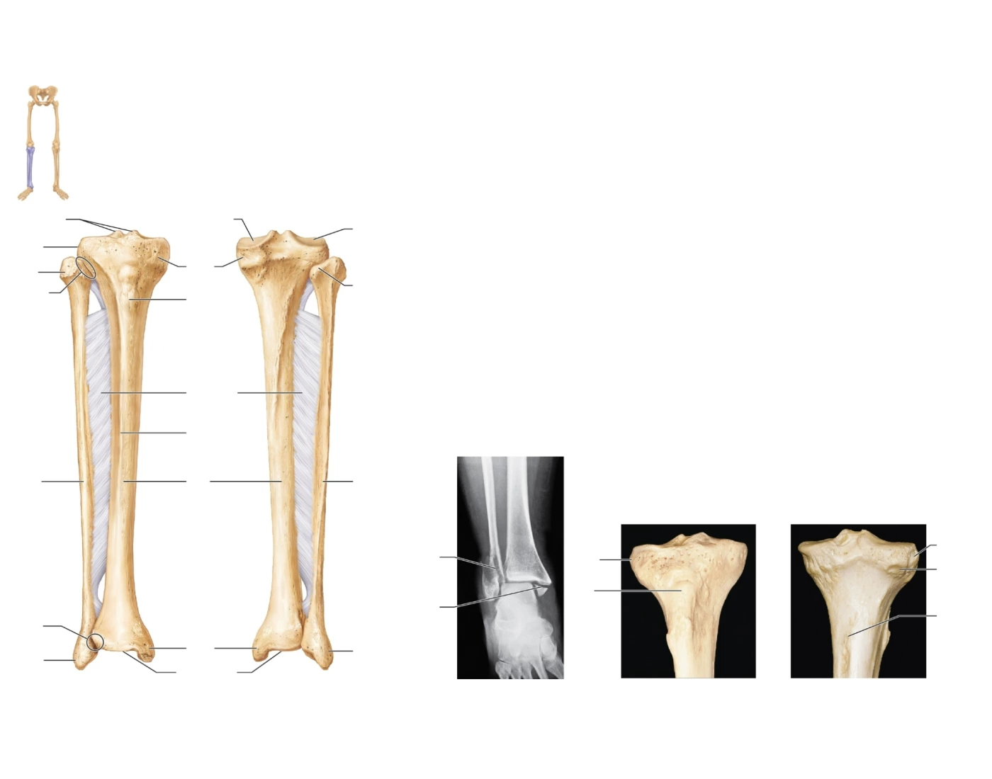 Tibia and Fibia Quiz