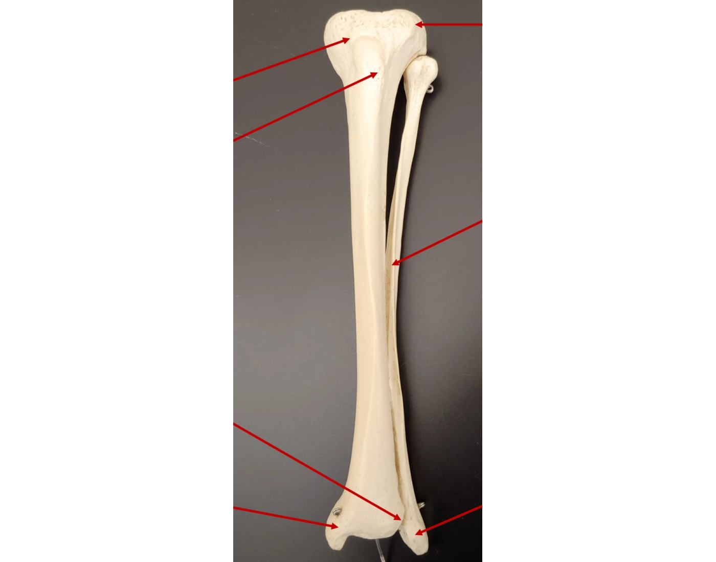 Tibia & Fibula (Left Anterior) — Printable Worksheet