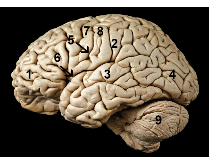 PNB 2264 Lab Practical 2 Label Brain Lateral View Quiz