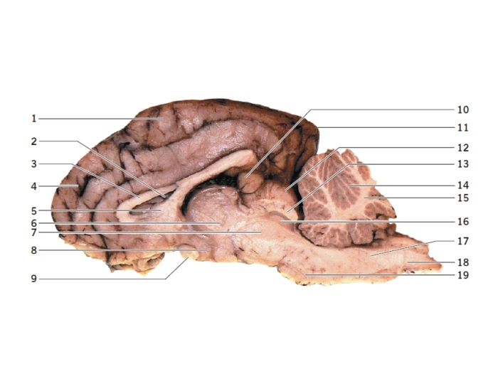 PNB Lab Practical 2 Label Brain Midsagittal View Quiz