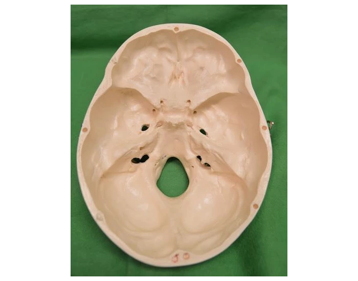 Bones and Landmarks of the interior skull Quiz