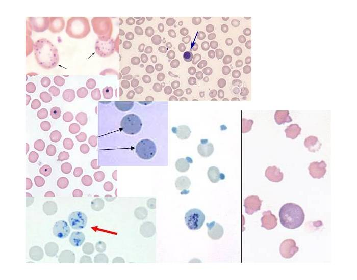 RBC Inclusions Quiz