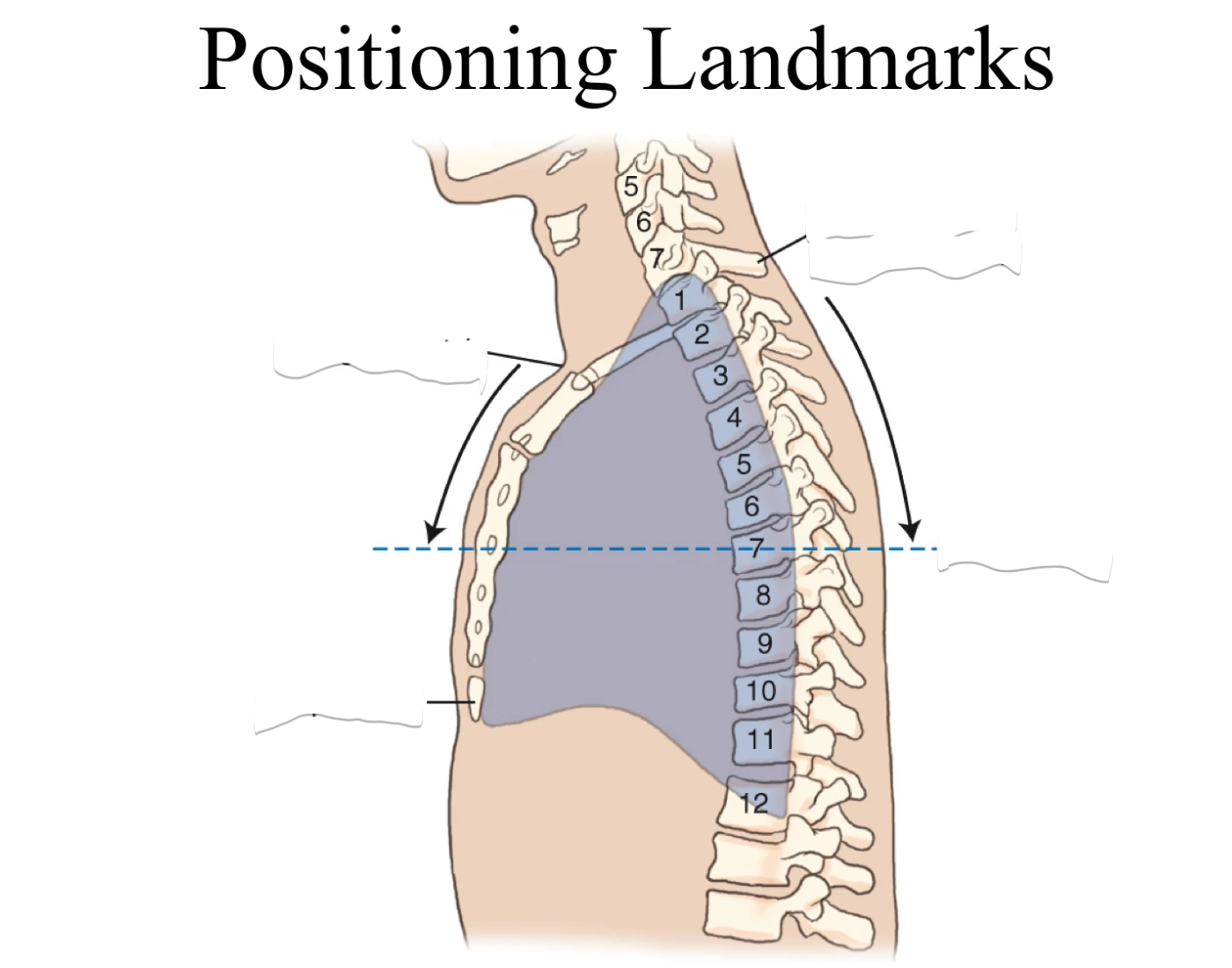 Chest Positioning Chest Positioning Landmarks Quiz