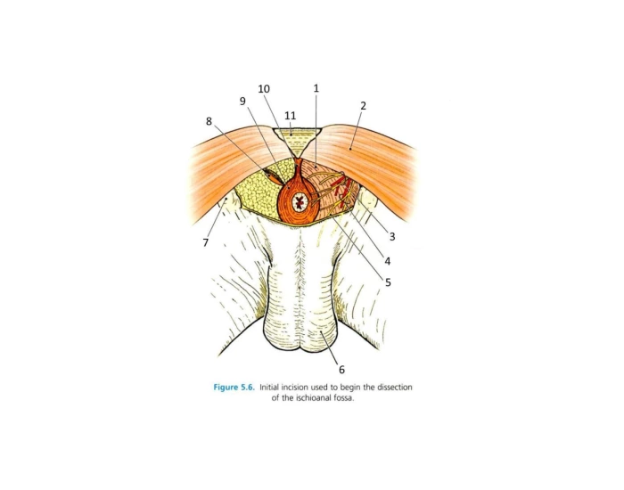 Initial incision used to begin the dissection — Printable Worksheet