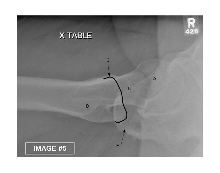 X-Table Lateral Hip — Printable Worksheet