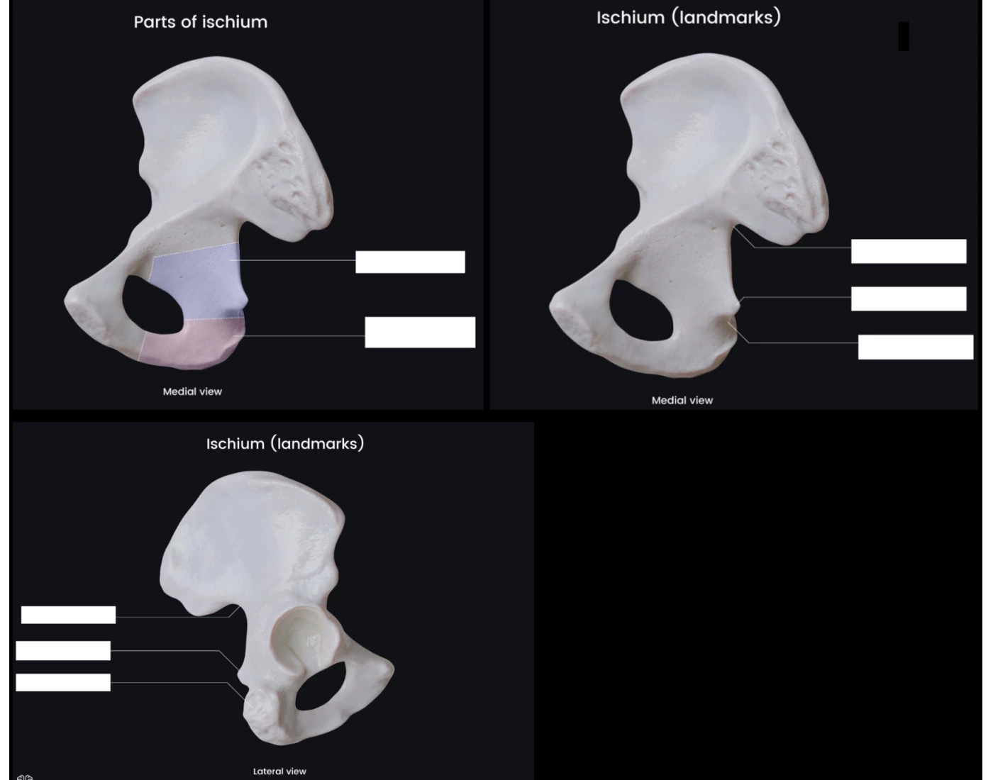 Hip Bone Anatomy- Ischium — Printable Worksheet