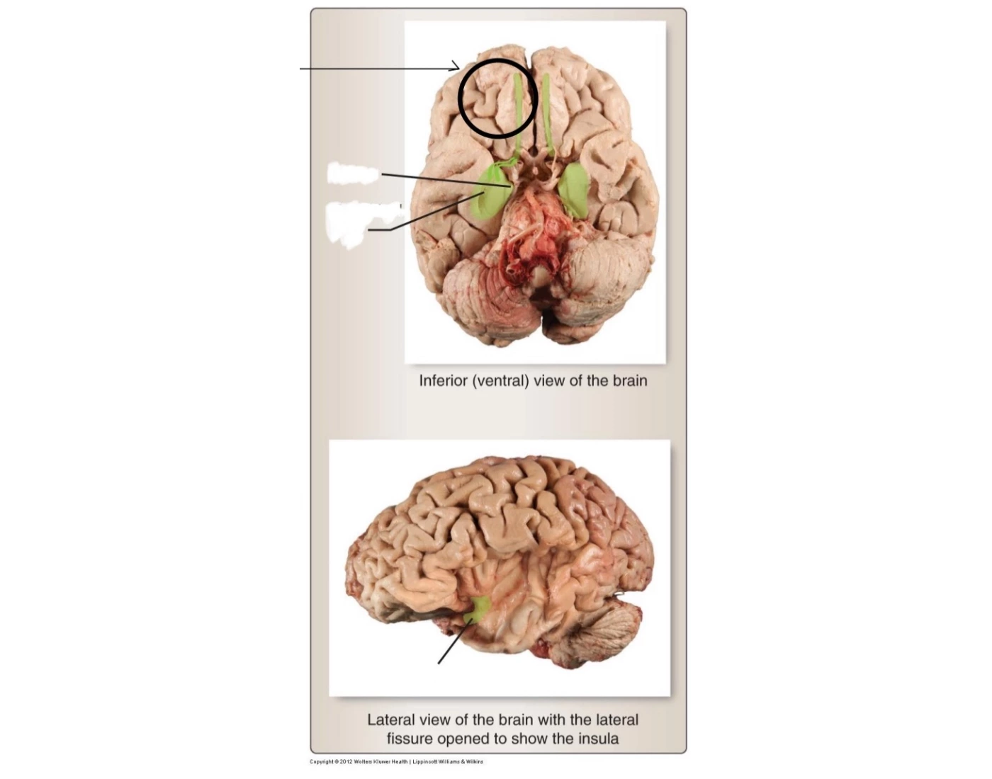 Piriform area (part of primary olfactory cortex) — Printable Worksheet