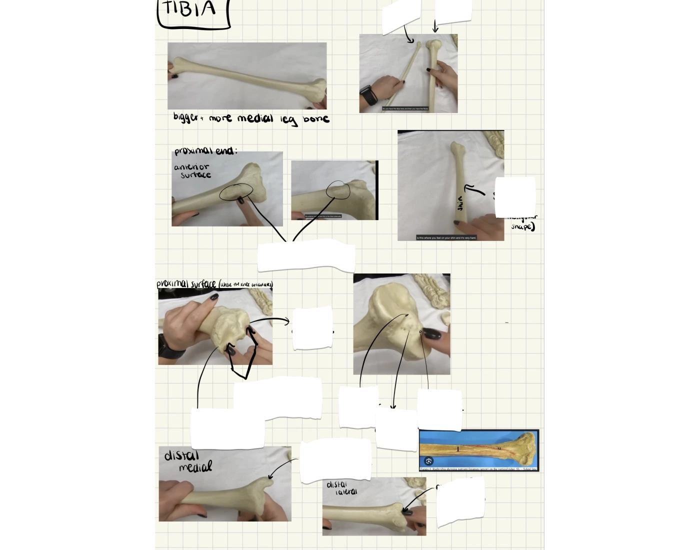 Tibia Pt.1 — Printable Worksheet