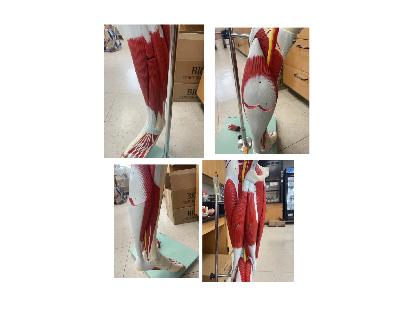lower leg Quiz