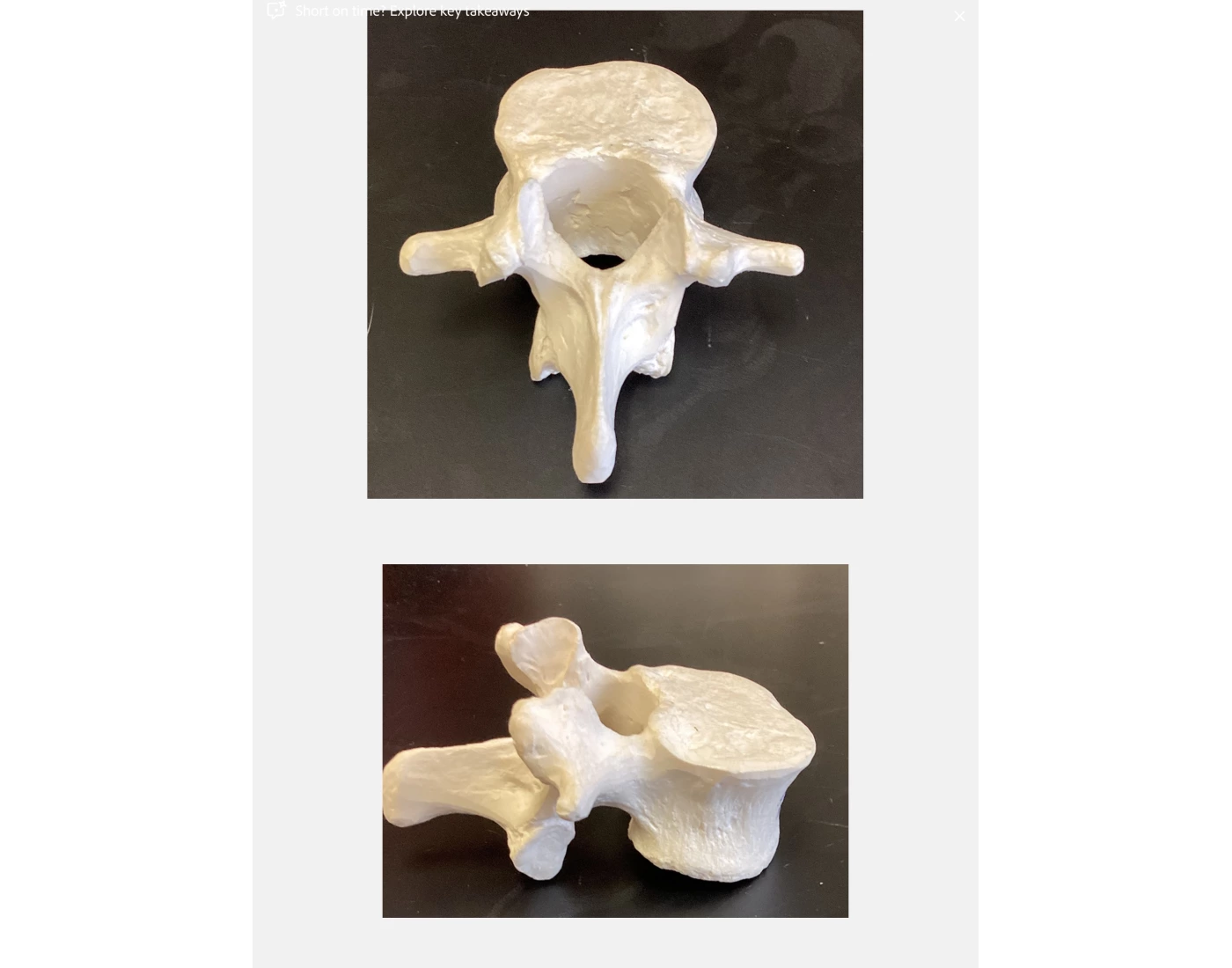 BIO 254 - P2 - Lumbar vertebra Quiz