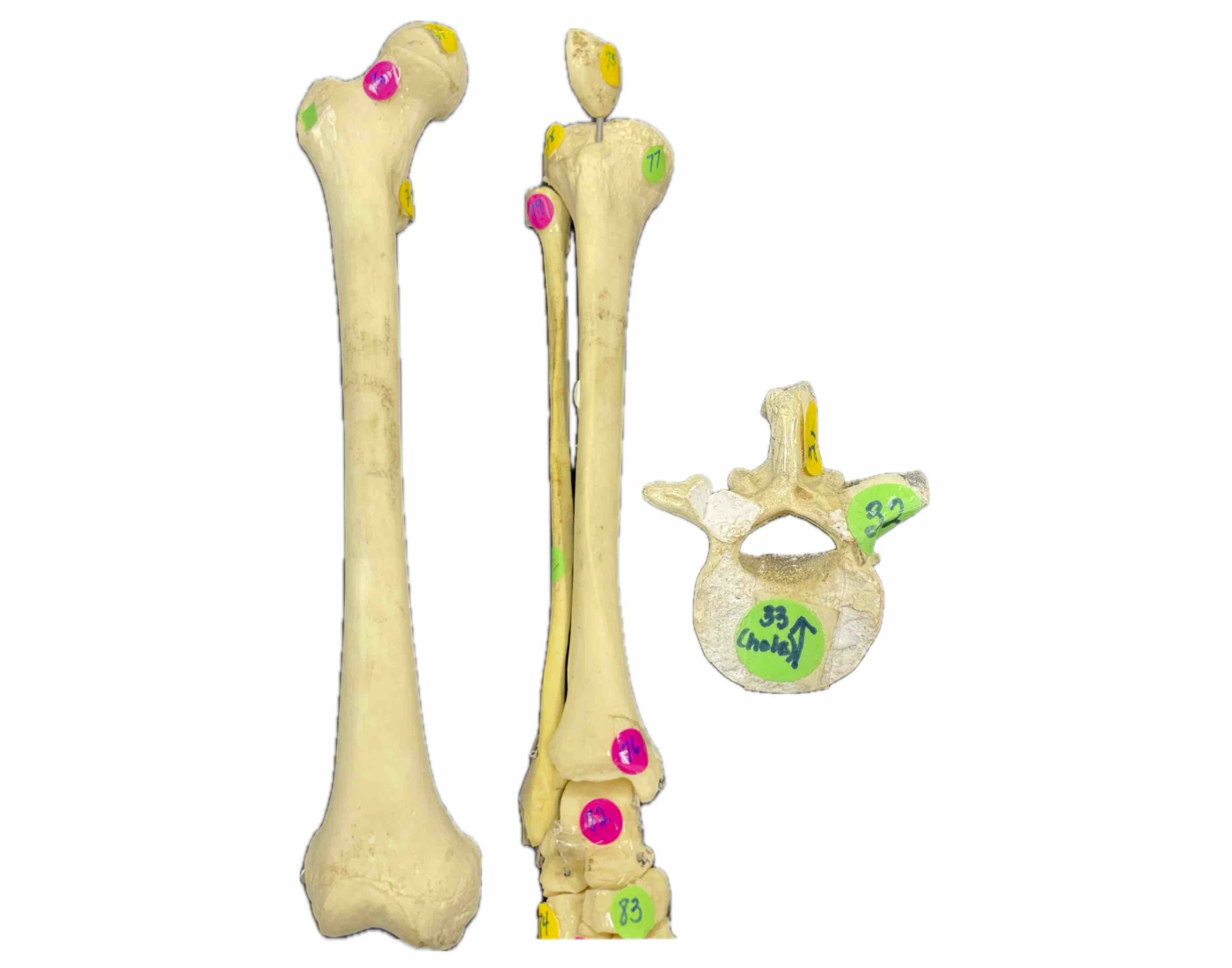 Bone markings of Femur, Tibia, Fibula, and Vert. — Printable Worksheet