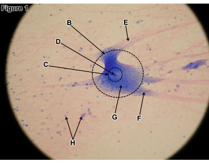 Multipolar Neuron Printable large multipolar neuron histology — Printable Worksheet