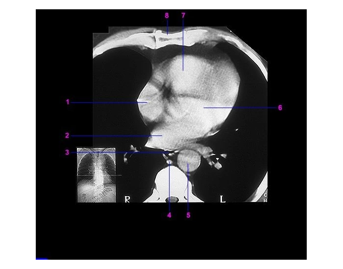 Ct Scan Worksheet.pdf Cardiac CT Identify — Printable Worksheet