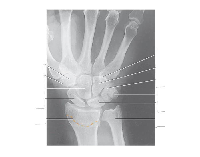 PA WRIST PROJECTION PROCEDURES Quiz